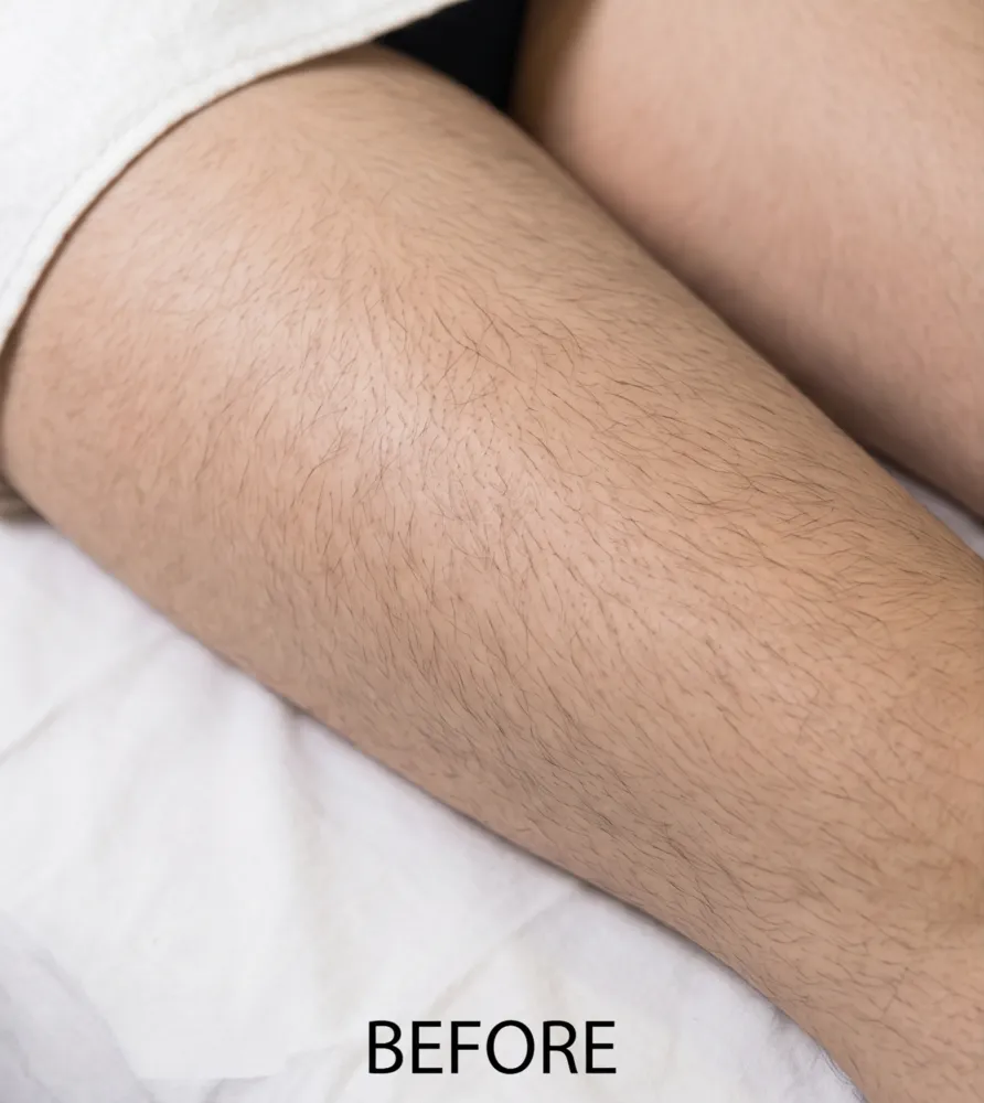 Modified Image