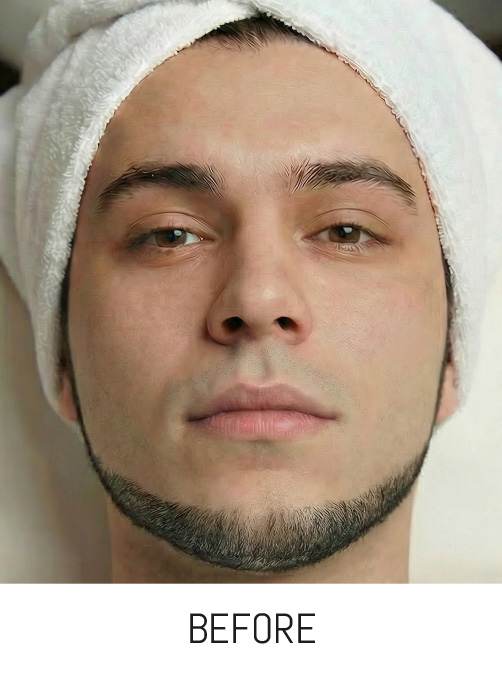 Modified Image