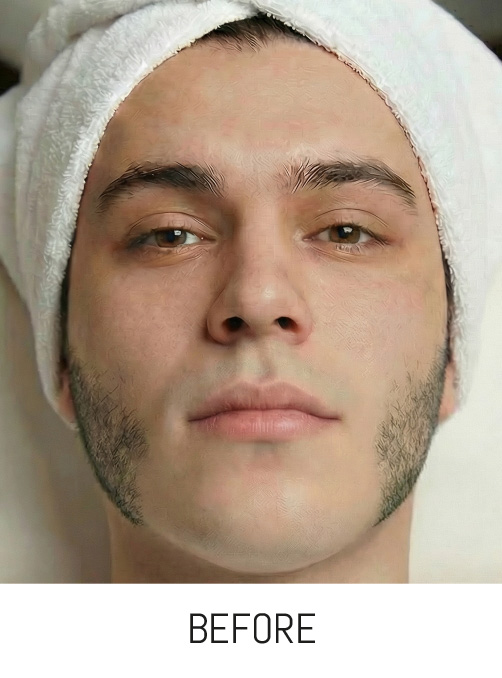 Modified Image