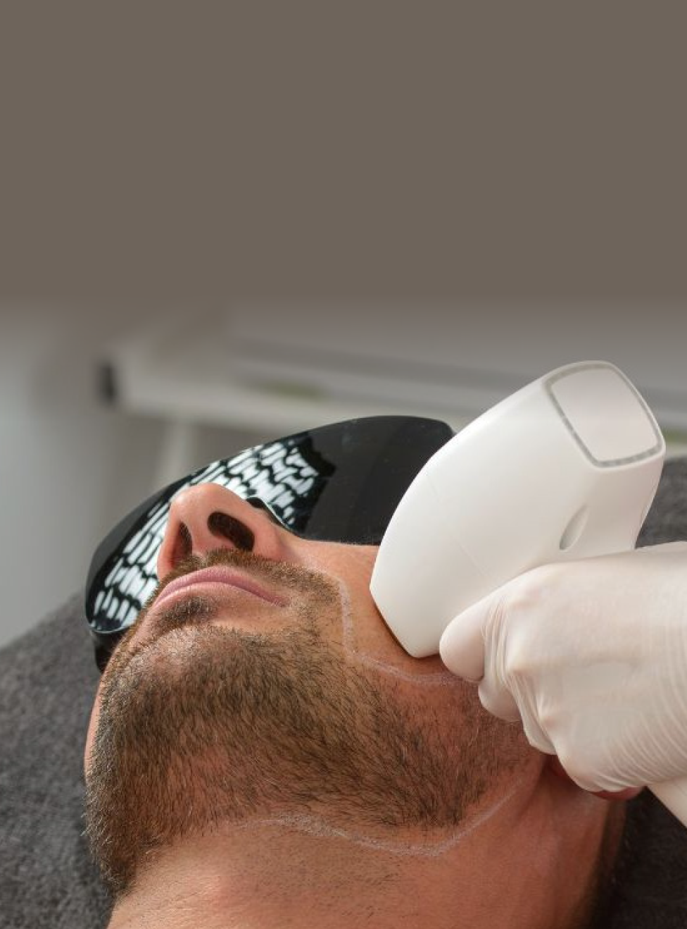 Man met huid tijdens laserontharing