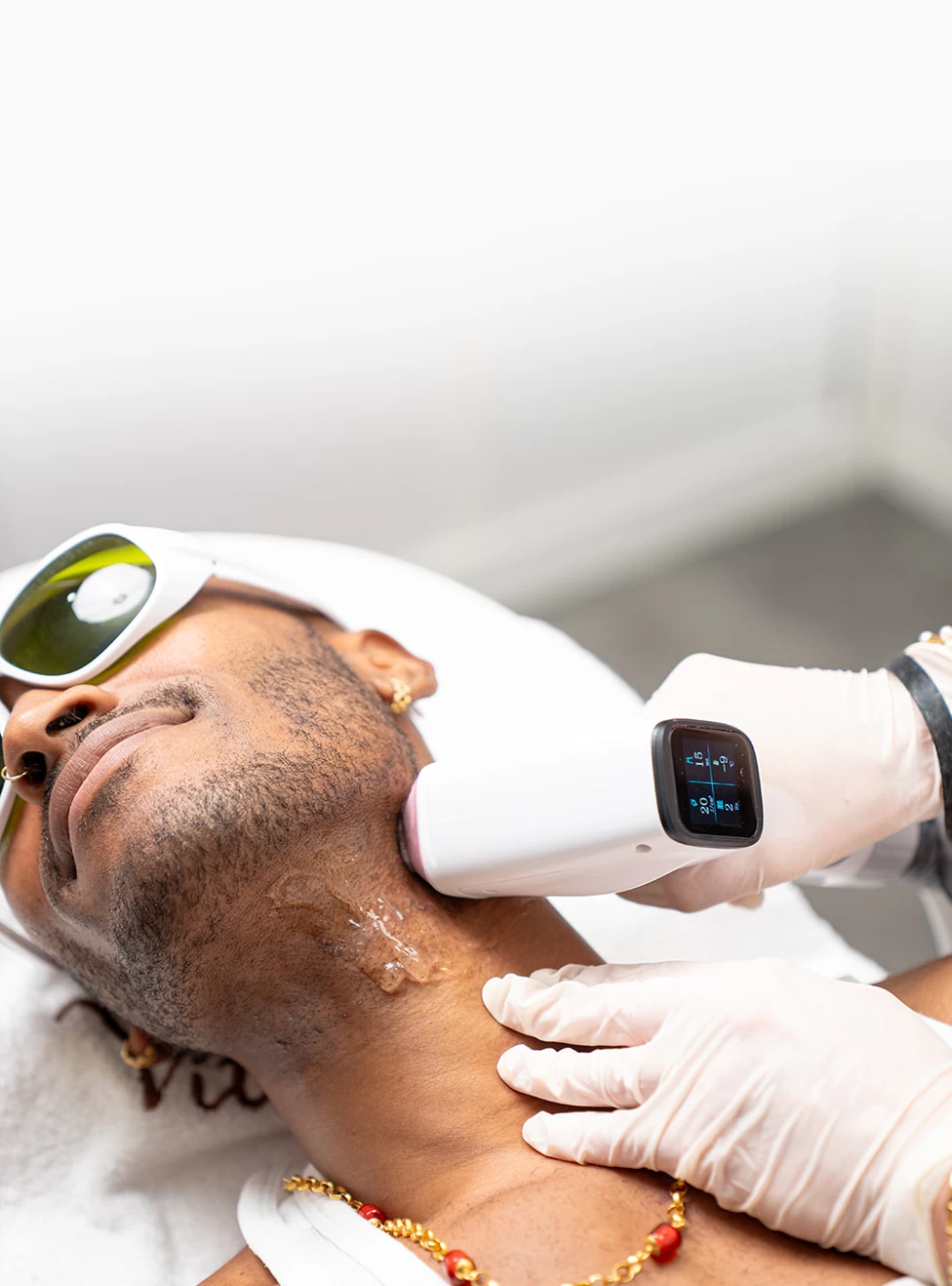 Laser ontharen man baard